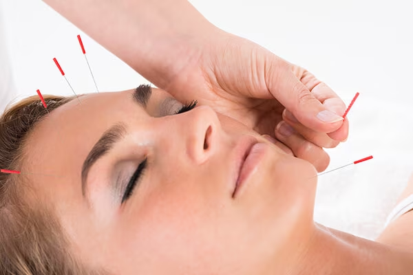 Acupressure and Acupuncture Treatment