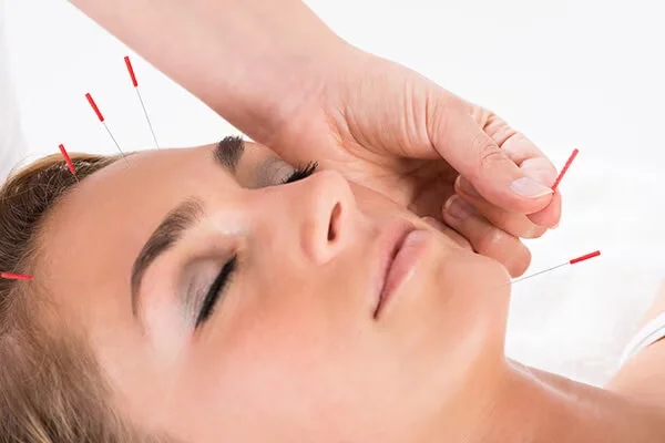 Acupressure and Acupuncture Treatment